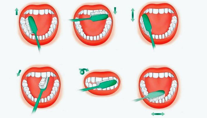Как правильно чистить зубы? 